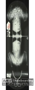 X-Ray - Dyrdek