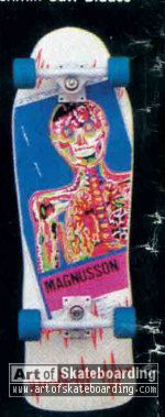 Magnusson X-ray